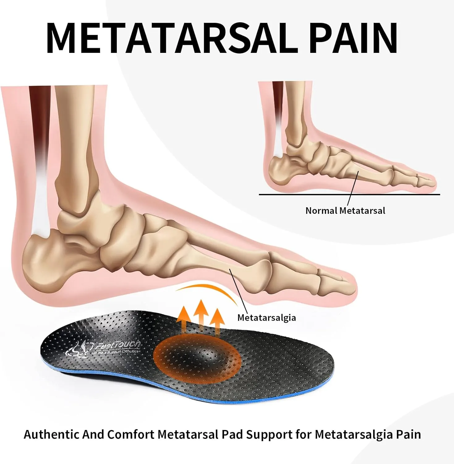 Best Genuine Leather Original Metatarsalgia Orthotics Strong Arch Support PORON Inserts Carbon Fiber PU Ball of Foot Insoles Relieve Morton's Neuroma Pain with Metatarsal Pad