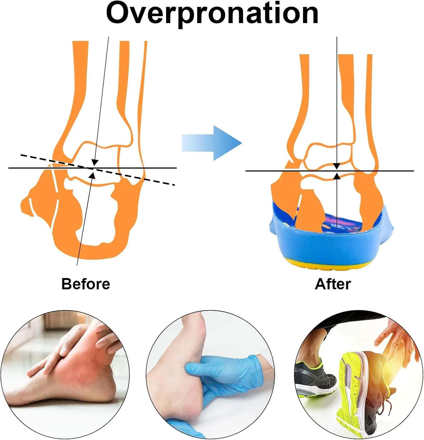 Kids Arch Support Orthotics Plantar Fasciitis Flat Feet PU Foam Inserts Relieve Foot Back Hip Leg and Knee Pain, Gel Cushion for Heel Pain