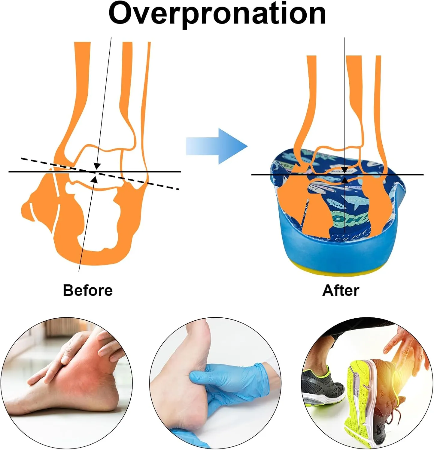 Kids Insoles for Over-Pronation Soft PU Foam Orthotics Relieve Plantar Fasciitis Flat Foot Child Inserts Gel Heel Cushion (Multicolor, 5-7M Big Kid)